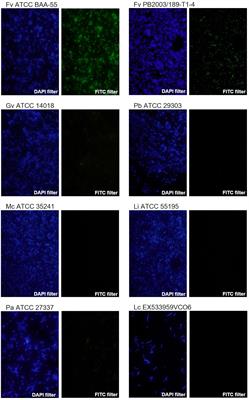 A New PNA-FISH Probe Targeting Fannyhessea vaginae